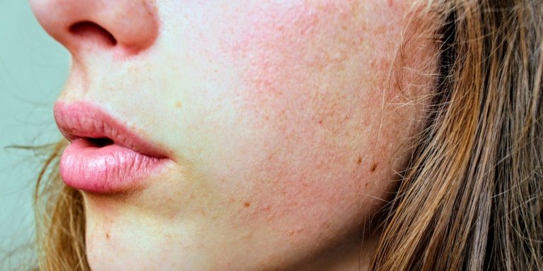 Face Serum for Sensitive Skin