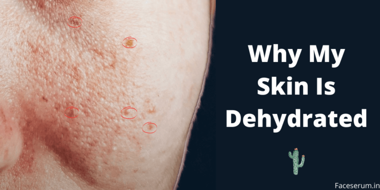 Skin Dehydration: Causes & Easy Preventions