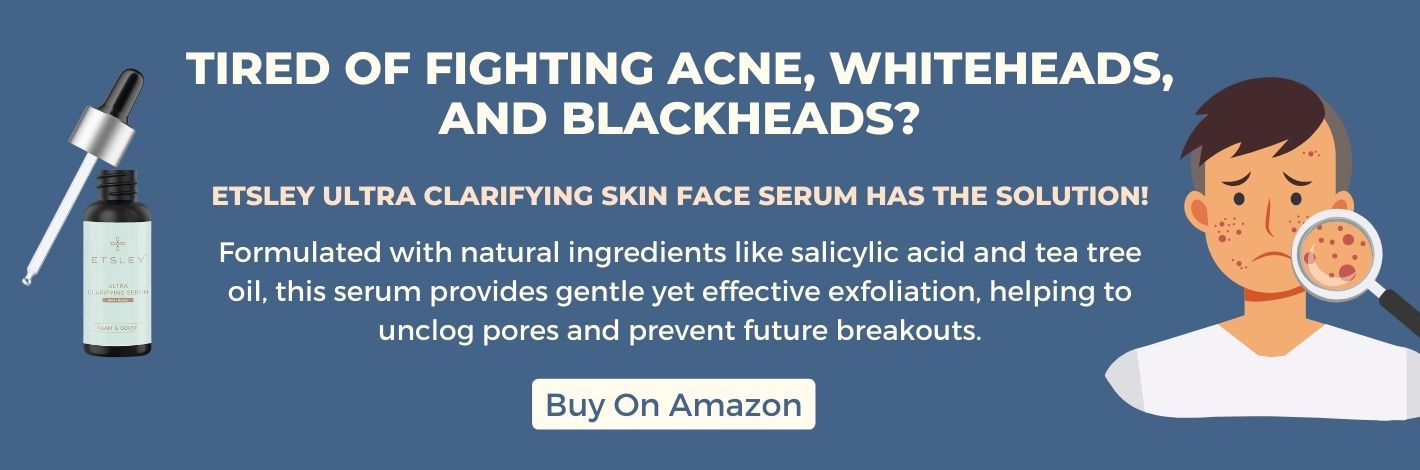 Face Serum for Acne and Blackheads
